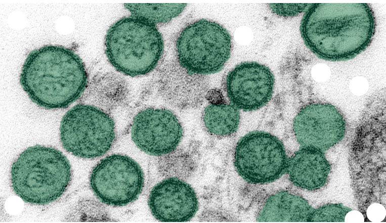 virus 