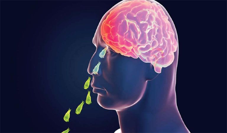 Amebic Meningoencephalitis 