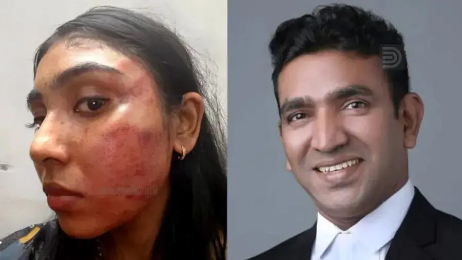 junior lawyer assaulted by senior