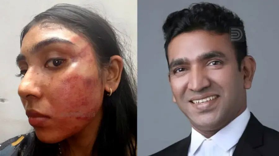 junior lawyer assaulted by senior