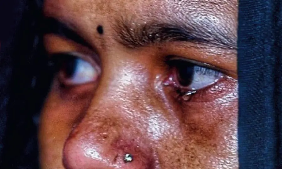 Chhattisgarh Malayali Nuns Arrest