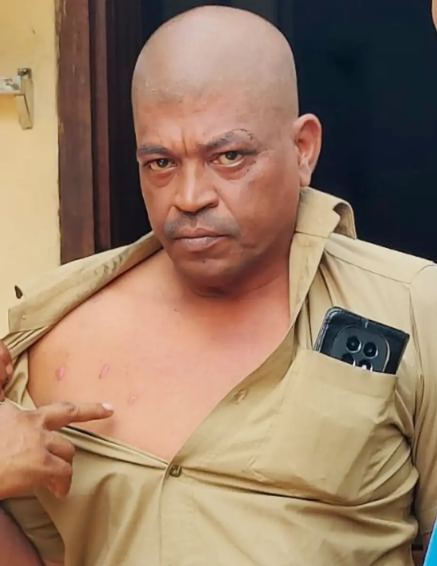 സൂര്യാതപമേറ്റ ഓട്ടോ ഡ്രൈവർ ജയൻ