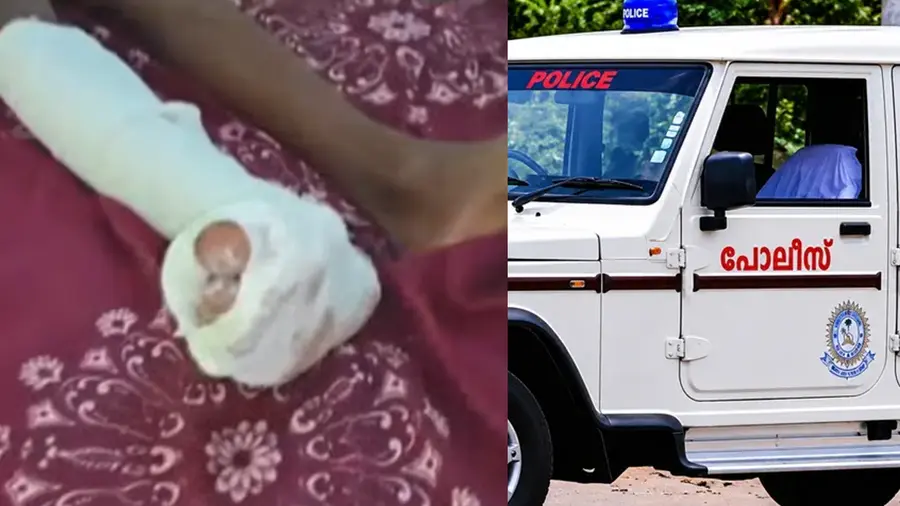 Police attack 