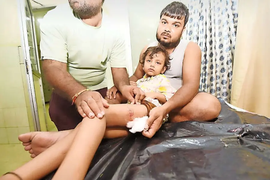 വീട്ടിൽ കളിച്ചുകൊണ്ടിരിക്കെ തെരുവുനായയുടെ കടിയേറ്റ ഉത്തരേന്ത്യൻ
സ്വദേശിനി ഏഴുവയസുകാരി കീർത്തിയെ ജില്ലാ ആശുപത്രിയിൽ എത്തിച്ചപ്പോൾ