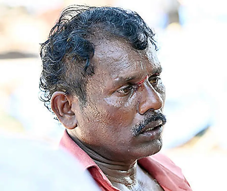 പയ്യാമ്പലം ശ്മാശാനത്തിലെ
സംഘർഷത്തിൽ മുഖത്ത് പരിക്കേറ്റ രഞ്ജൻ