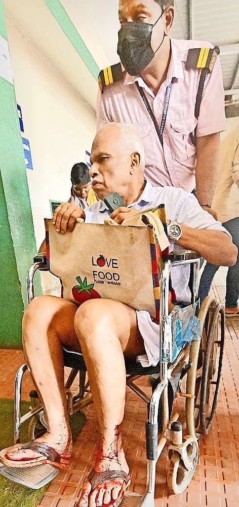 ഒന്നരവയസ്സുള്ള കുട്ടി ഉൾപ്പെടെ 21 പേർക്ക്‌ ബുധനാഴ്‌ച തെരുവുനായയുടെ കടിയേറ്റു. 