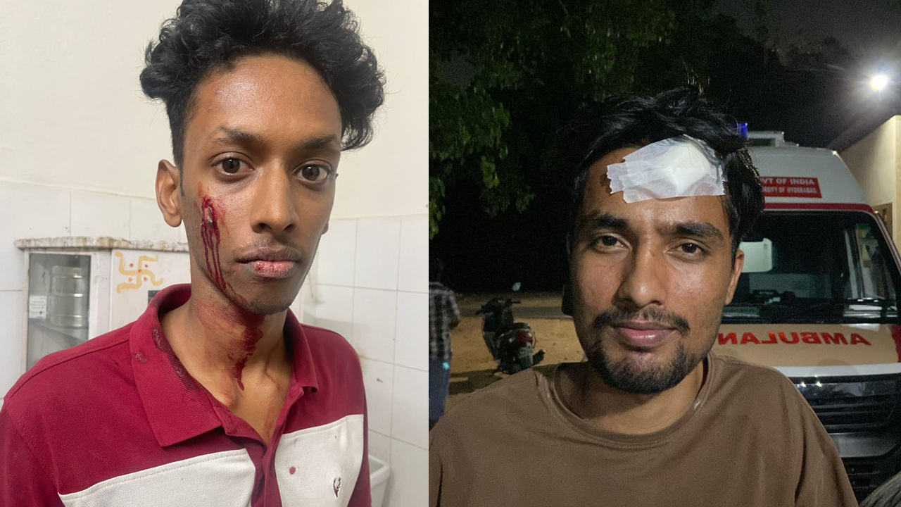 ABVP attack