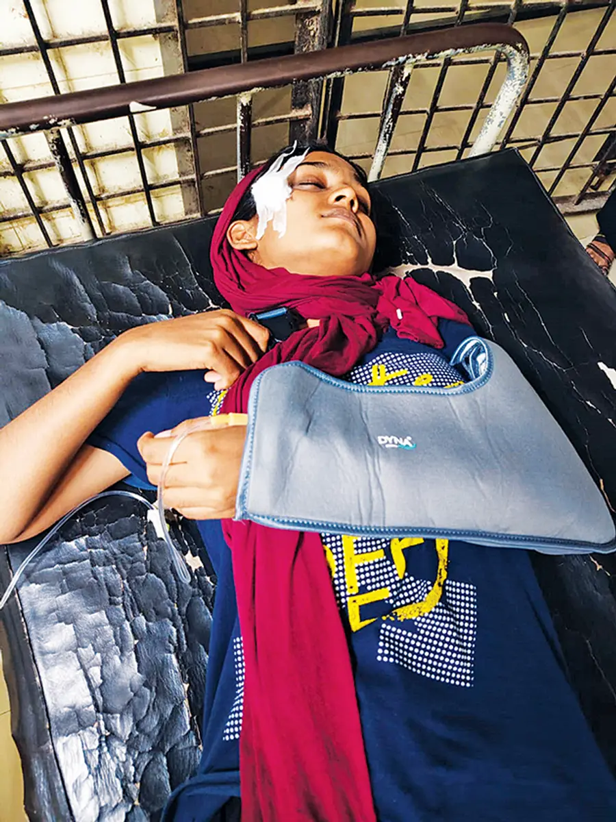 എസ്ഡിപിഐ ക്രിമിനലുകളുടെ കല്ലേറിൽ പരിക്കേറ്റ അമ്പലപ്പുഴ
വടക്ക് പഞ്ചായത്ത് രണ്ടാം
വാർഡിലെ എൽഡിഎഫ്
സ്ഥാനാർഥി ബീമ സനീഷിന്റെ മകൾ ആമിന ചികിത്സയിൽ