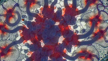 Amebic Meningoencephalitis 