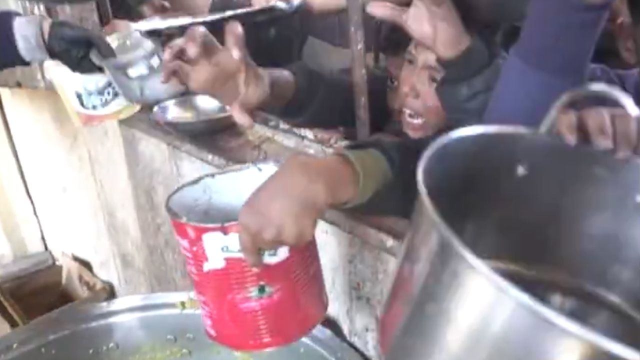 Gaza malnutrition