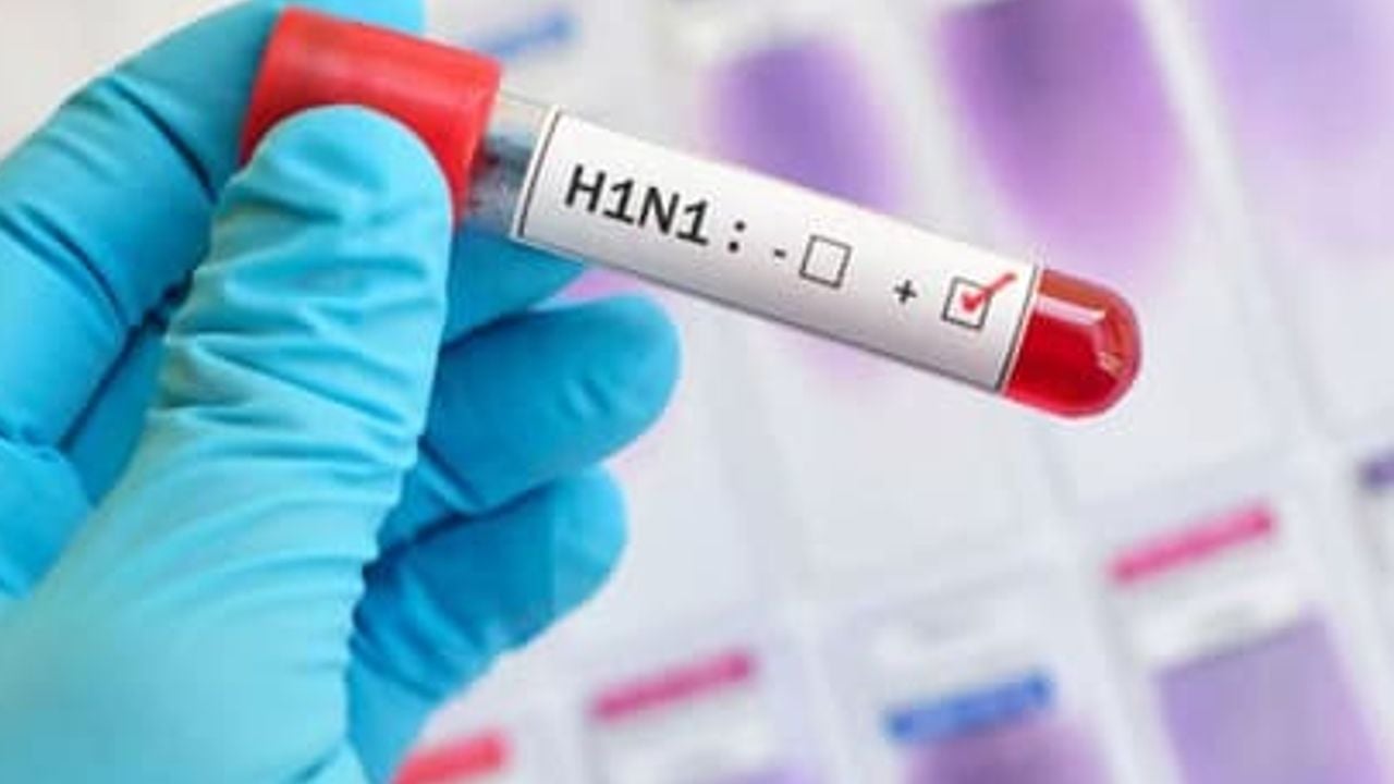H1 N1
