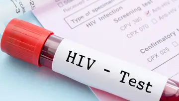 HIV.jpg