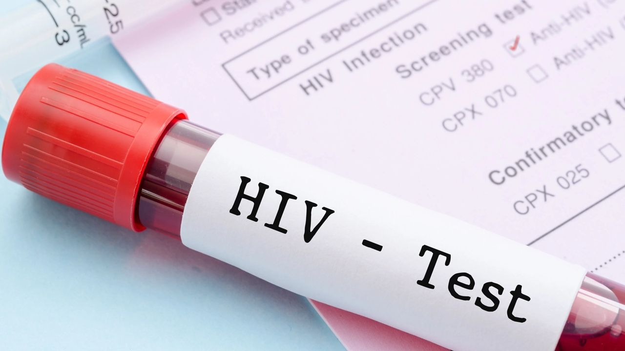 HIV.jpg