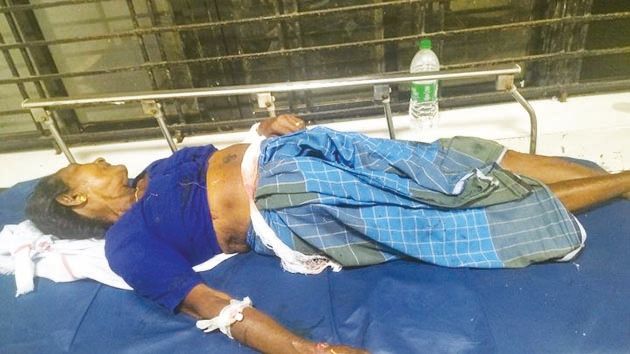 കരീലക്കുളങ്ങരയിൽ തെരുവുനായയുടെ കടിയേറ്റ ദേവകിയമ്മ