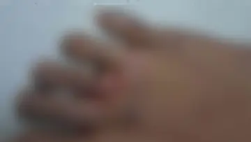 LEG