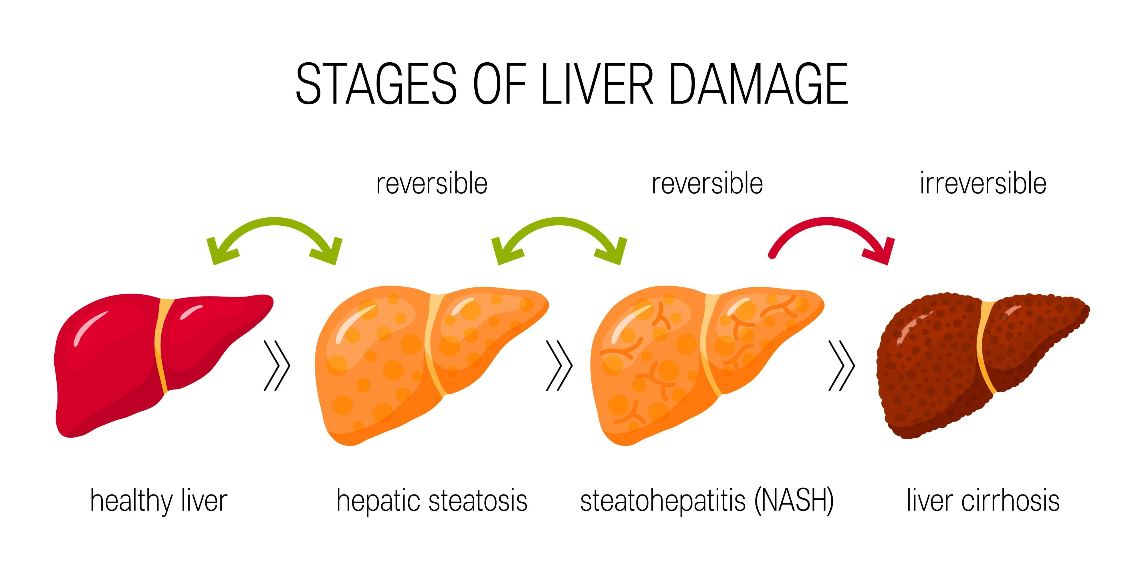 LIVER