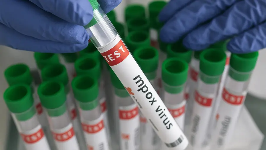 Mpox Monkeypox