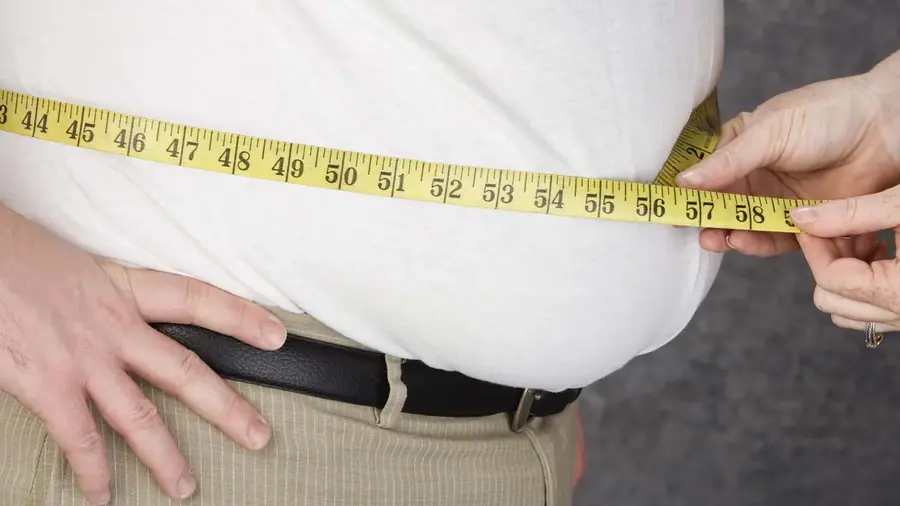 OBESITY