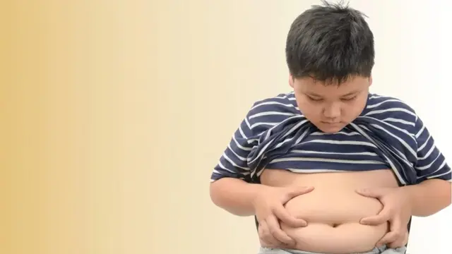 OBESITY