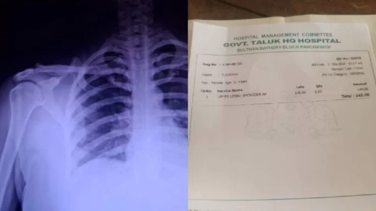 Patient X-Ray Photographed on Mobile .jpg
