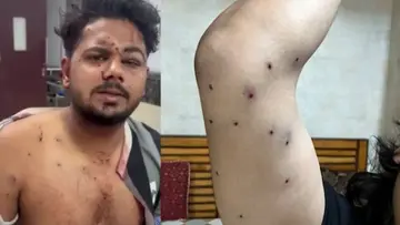 Pellet guns