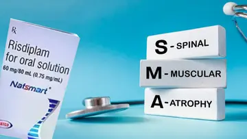Spinal Muscular Atrophy Risdiplam