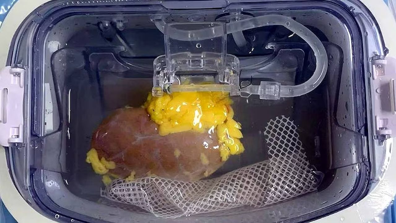 Universal kidney.jpg