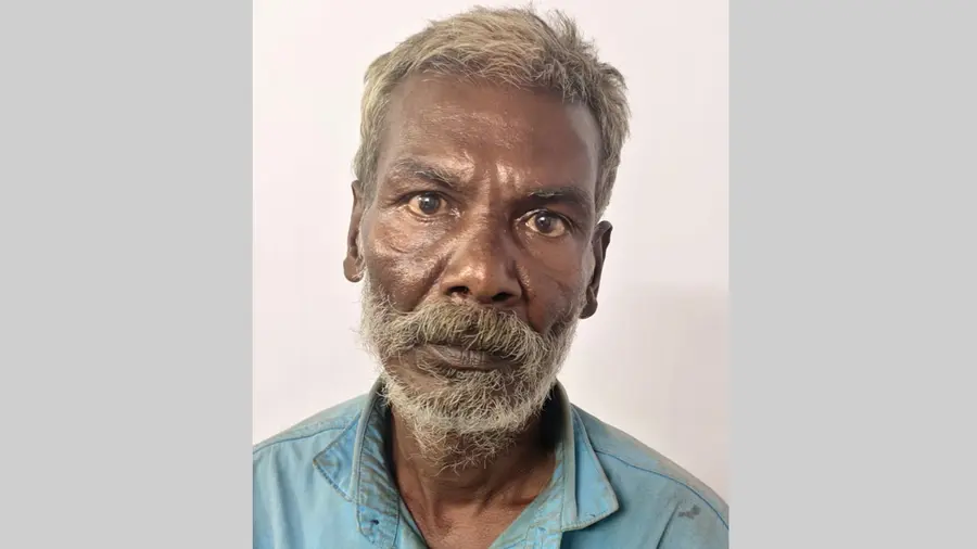 acid attack accused