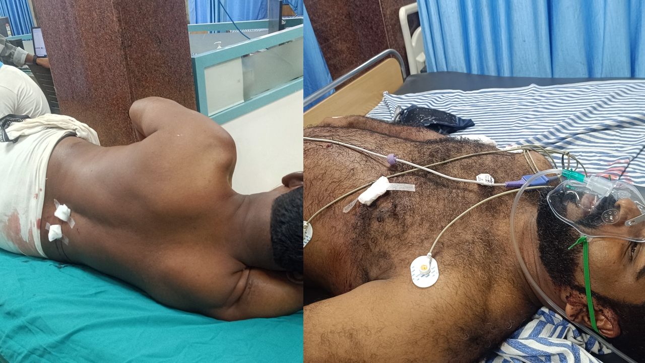 Congress-BJP attack against cpim workers