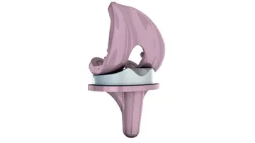 All-ceramic knee replacement