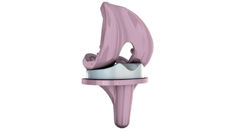 All-ceramic knee replacement