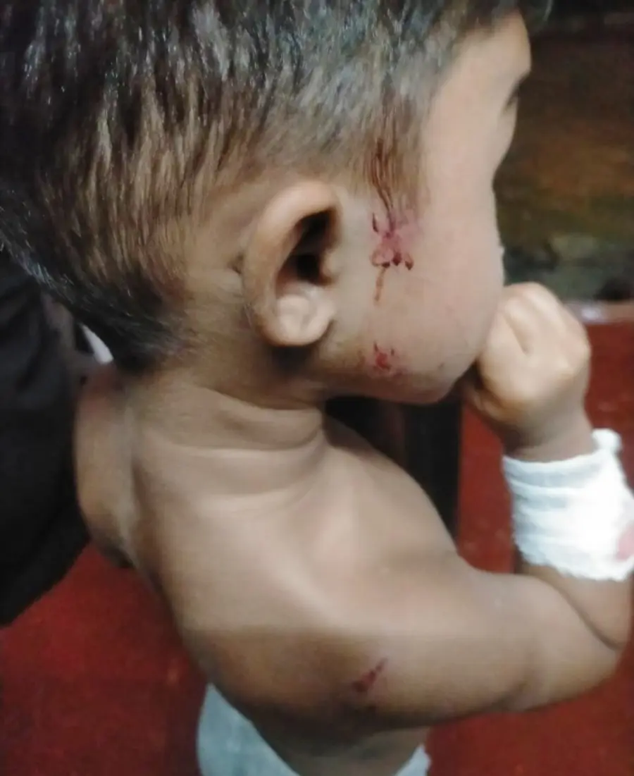 പരിക്കേറ്റ മുഹമ്മദ് അസ്ഹബ്