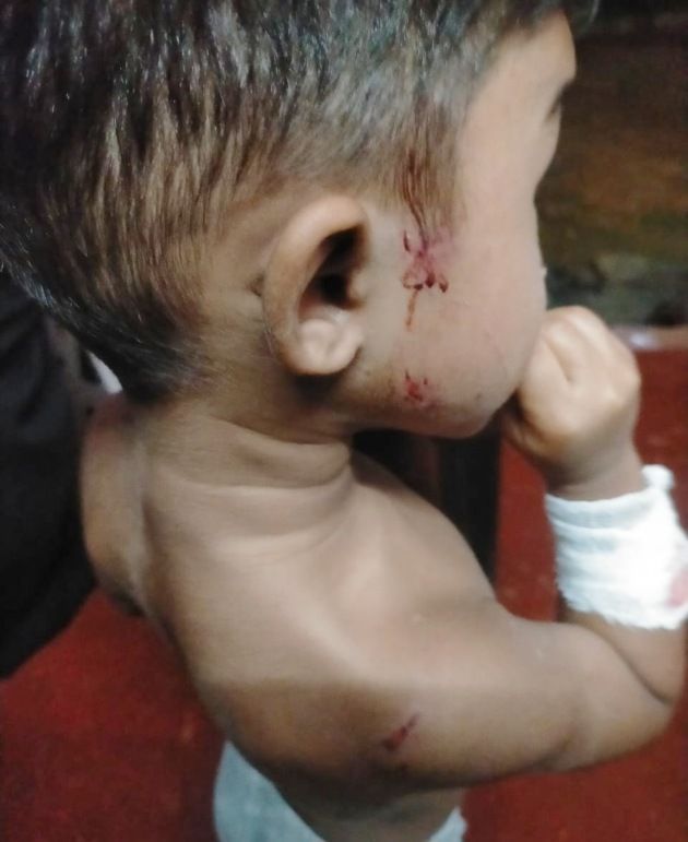 പരിക്കേറ്റ മുഹമ്മദ് അസ്ഹബ് 