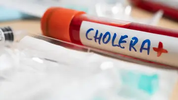 cholera