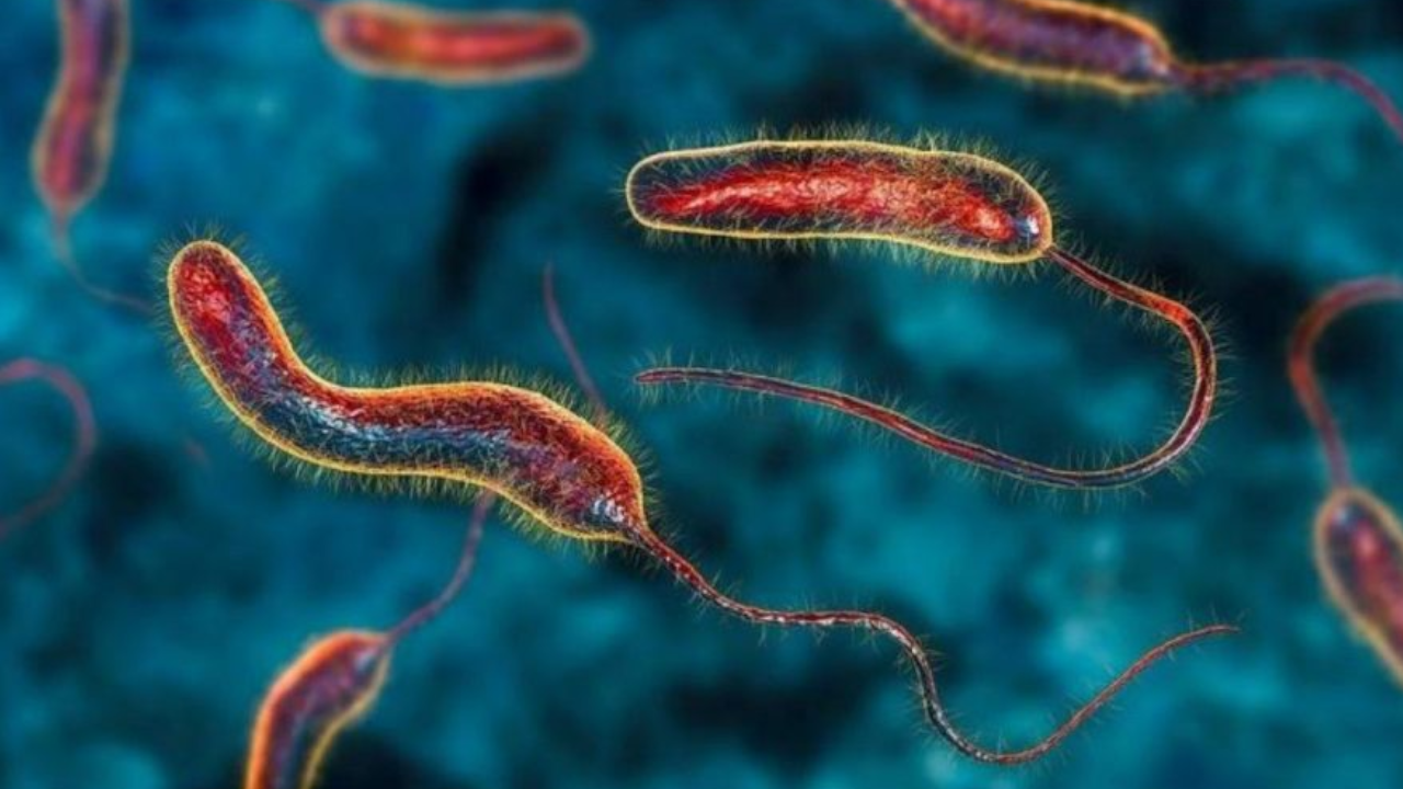 cholera