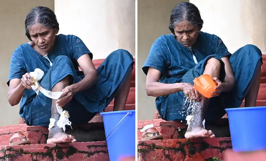 സിഎംഎസ് കോളേജ് ഹയർസെക്കൻഡറി സ്കൂളിലെ ക്യാമ്പിൽ തന്റെ കാലിലെ പരിക്ക് സ്വയം കഴുകി വൃത്തിയാക്കുന്ന സ്ത്രീ                                                                                                                                                                ഫോട്ടോ: മനു വിശ്വനാഥ്