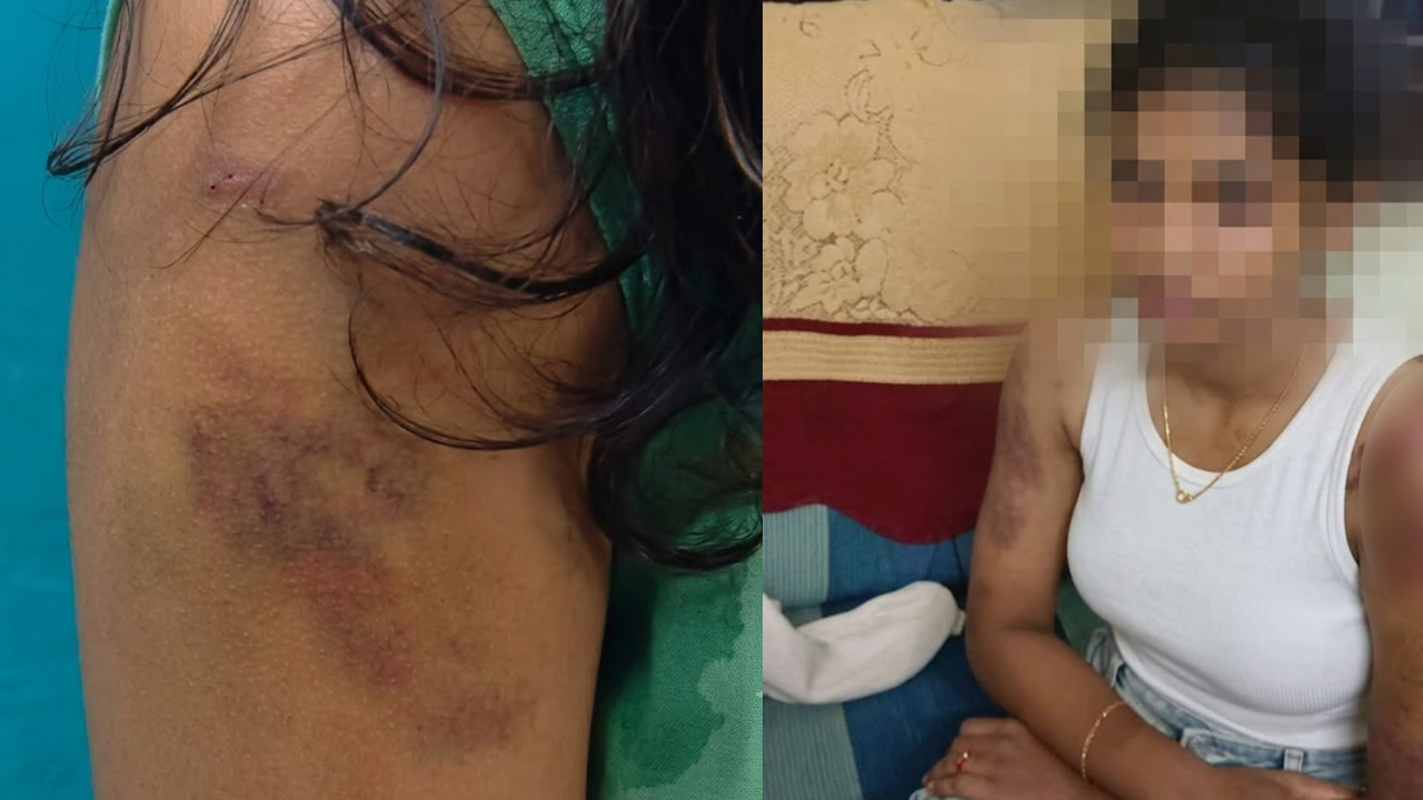 domestic violence 