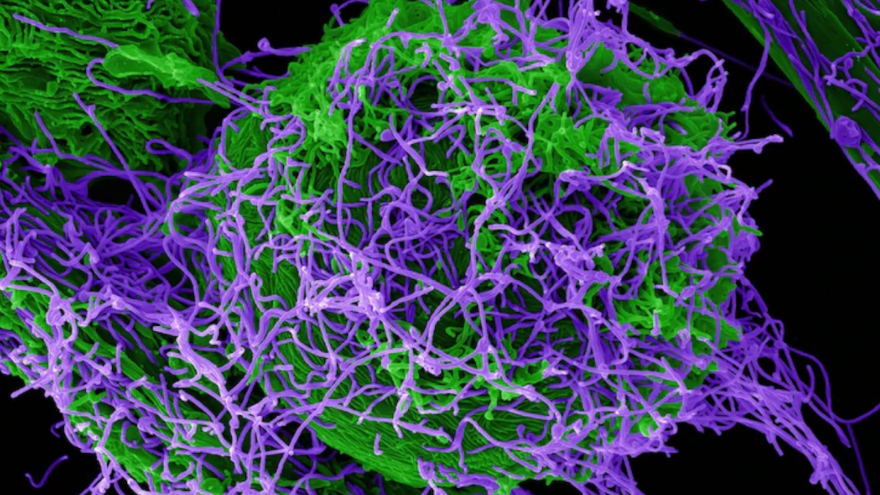 ebola