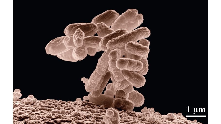 E. coli bacteria