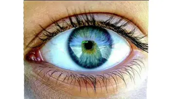Vision Day