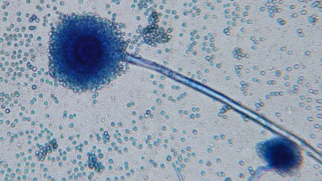 Aspergillus flavus