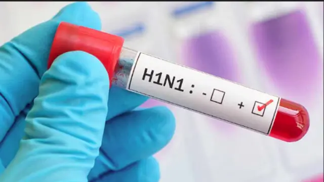 h1 n1