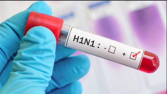 h1 n1