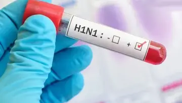 h1n1