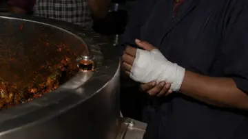 hand Injured