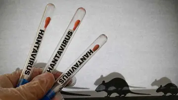 hanta virus