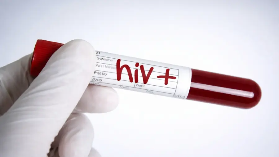 hiv positive