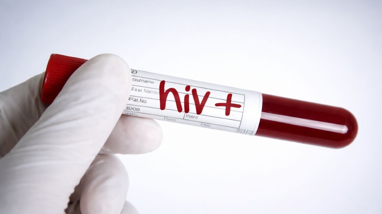 hiv positive