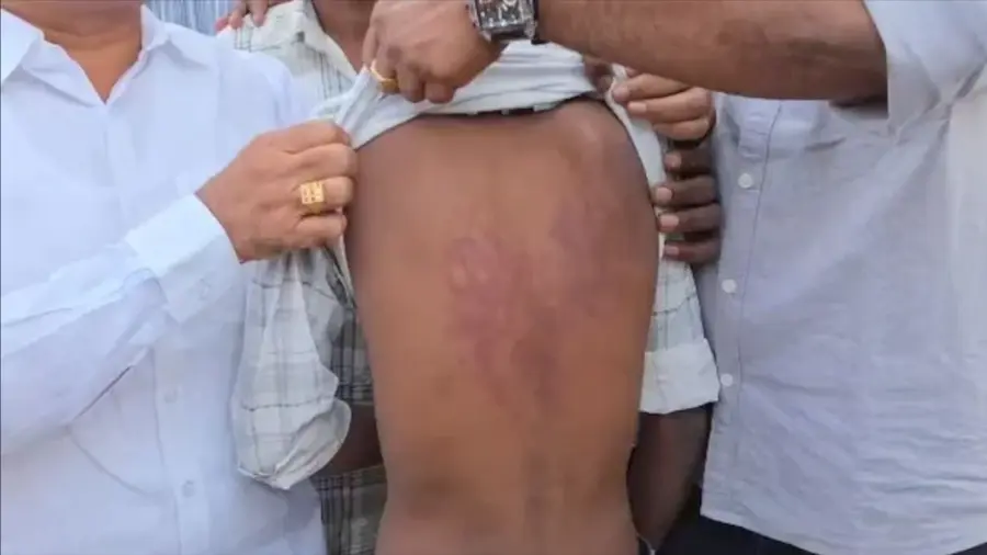 hyderabad student beaten up