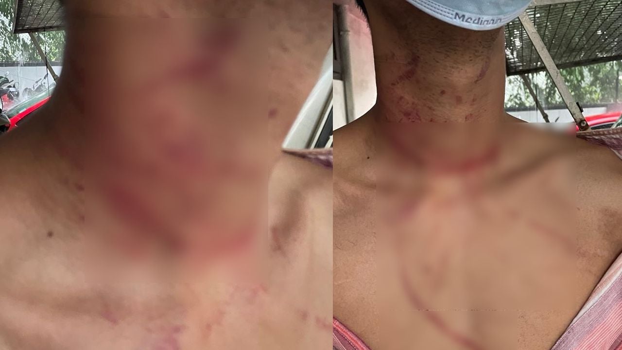 man beaten